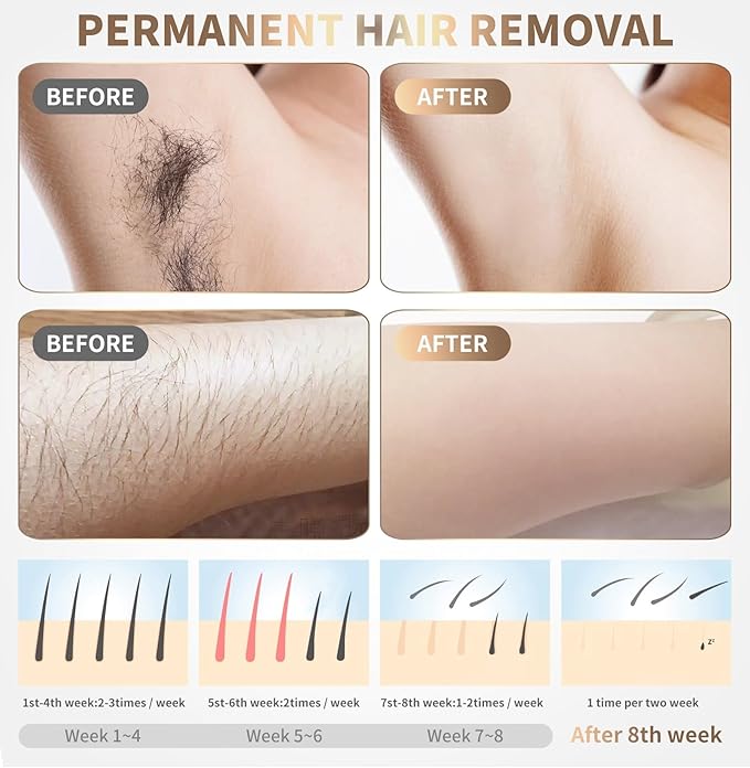 Mini Laser Hair Removal Device With Replacement Warranty