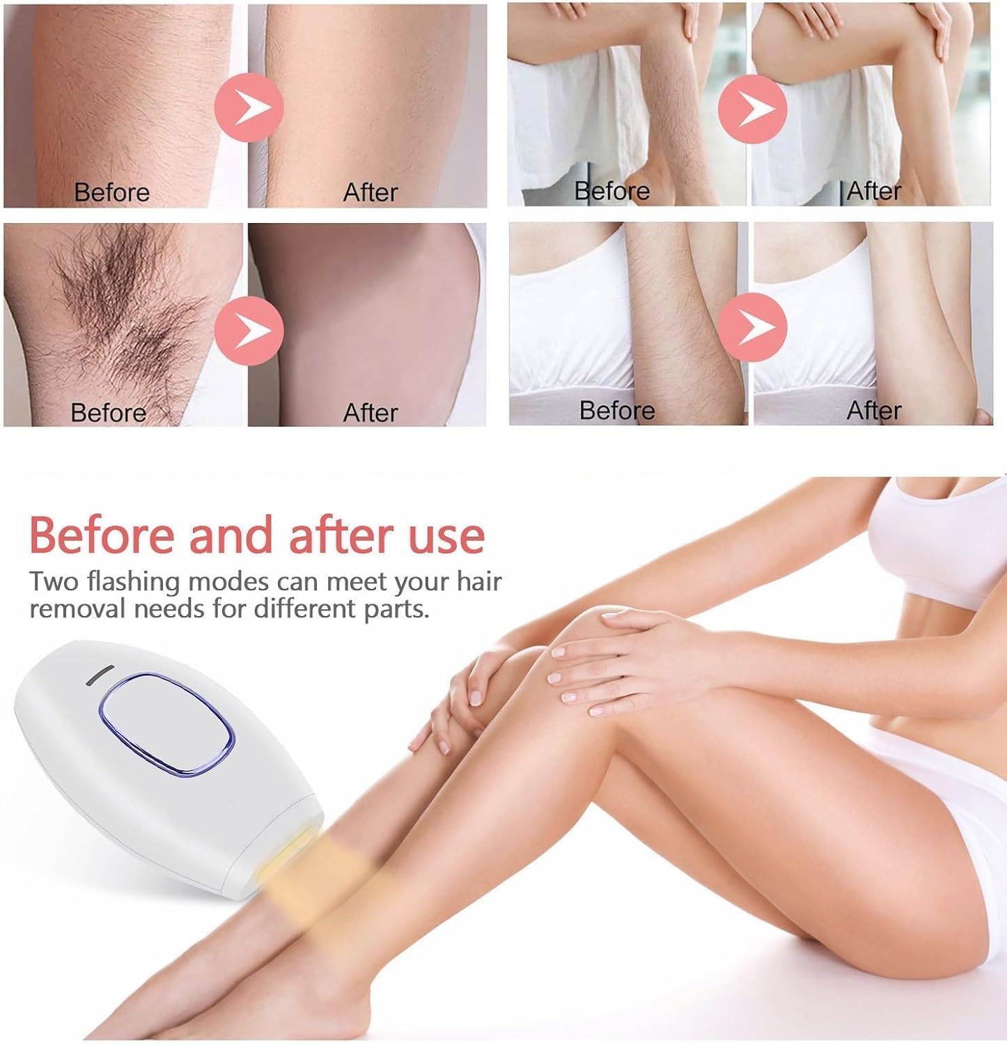 Mini Laser Hair Removal Device With Replacement Warranty